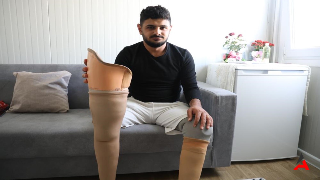 Depremde Bacaklarını Kaybeden Genç, Protez Hayaliyle