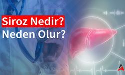 Siroz Nedir? Belirtileri Nelerdir