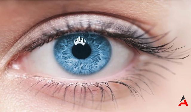 Keratokonus Göz Hastalığının Tanımı Belirtileri ve Tedavi Yöntemleri