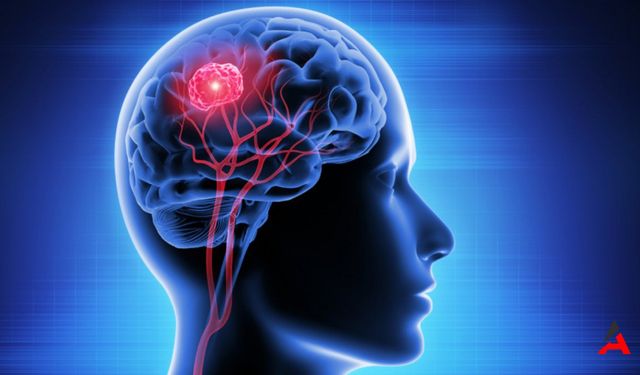 Beyin Tümörünün Belirtileri Nelerdir?