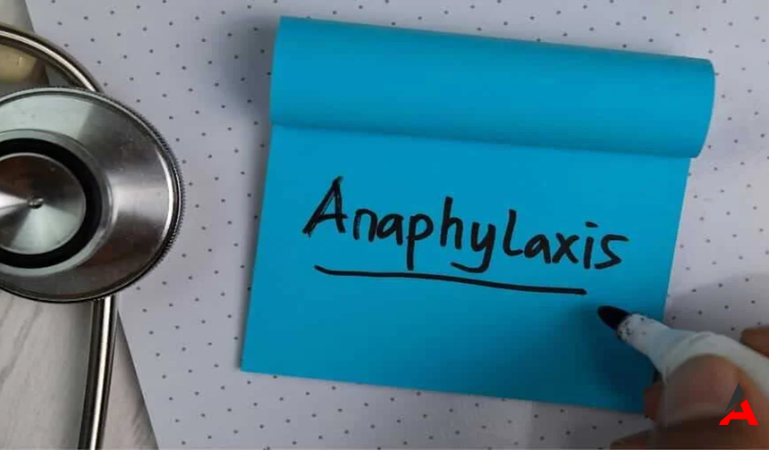 Anafilaksi Nedir? Anafilaksi Belirtileri, Nedenleri ve Tedavisi