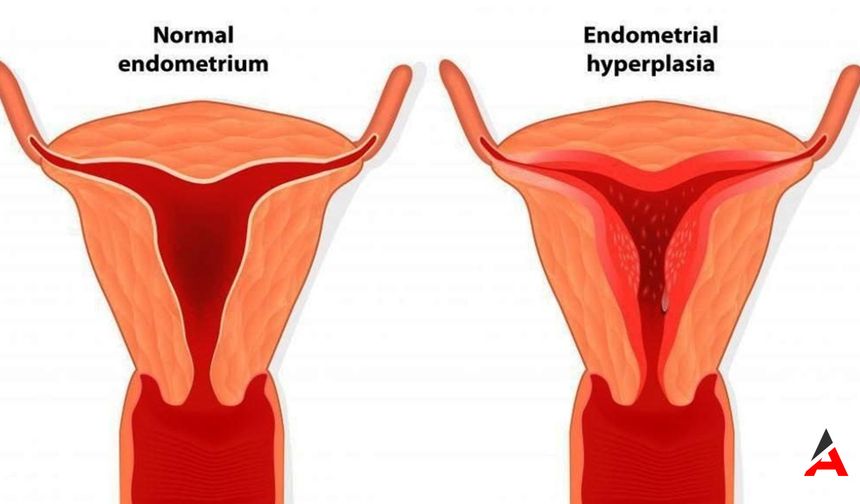 Rahim Duvarı Neden Kalınlaşır? Hormonal Dengesizlikler ve Obezite Riskleri!